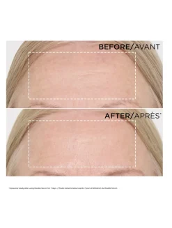 Double Serum