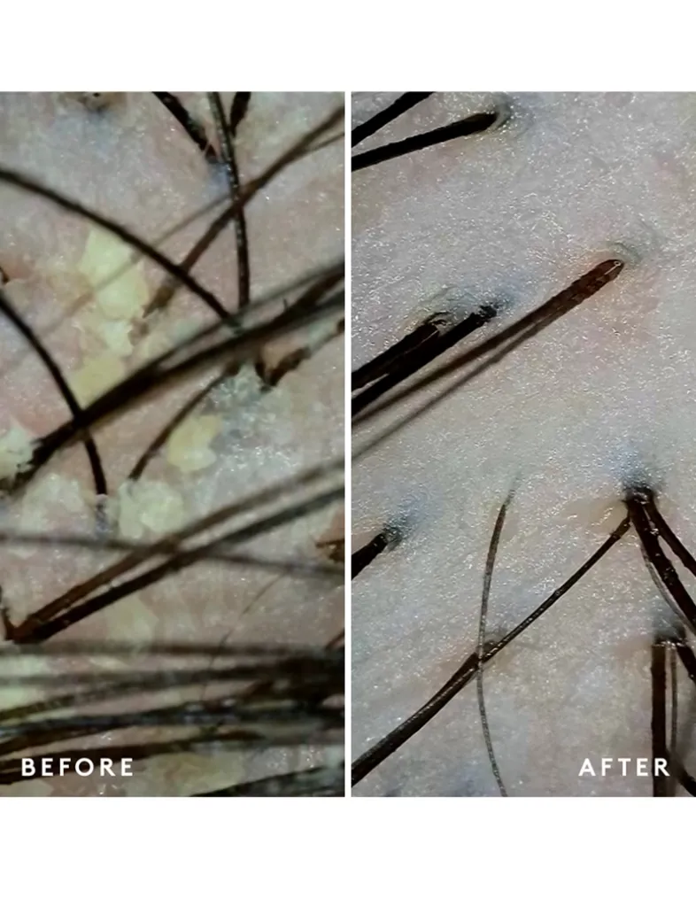 Scalp Remedy Shampoo
